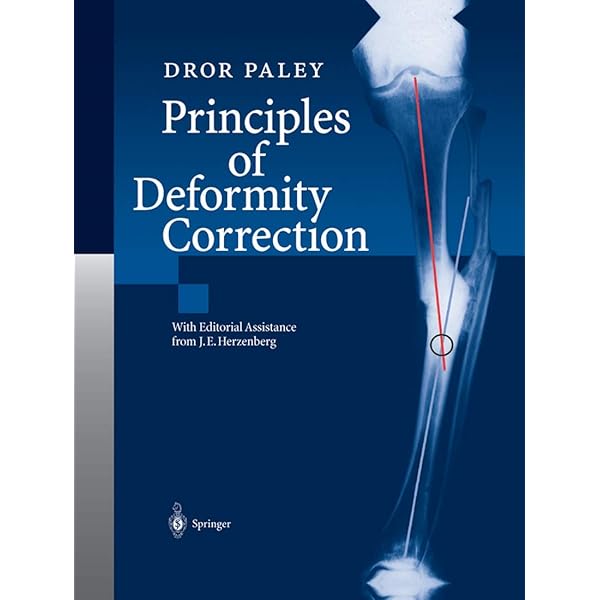 Principles of Deformity Correction 2003 Edition by Paley, Dror Principles of Deformity Correction 2003 Edition by Paley, Dror